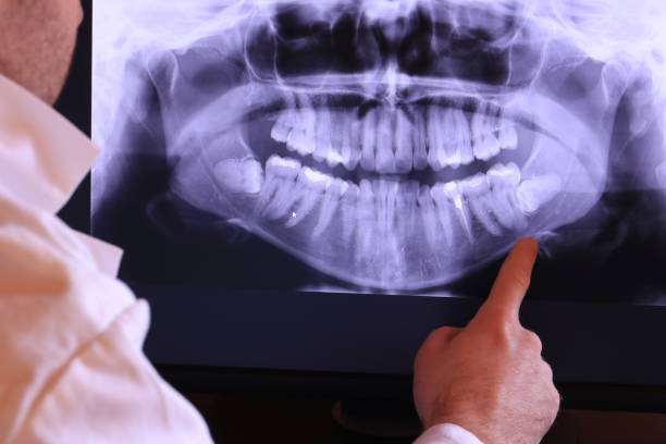 Best Urgent Care for Lost Fillings or Crowns in Drexel Hill, PA